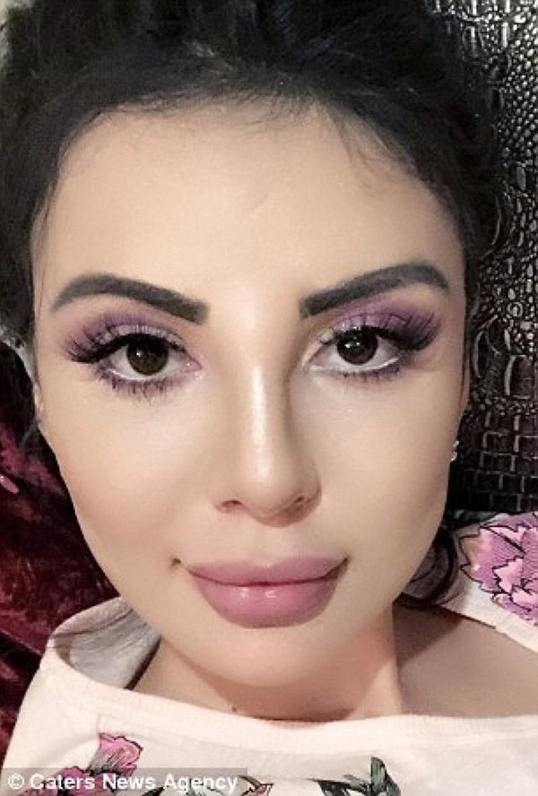 Mới đây, cô phẫu thuật mũi lần thứ hai để có khuôn mũi giống với Kim Kardashian hơn. Ngoài ra, cô còn loại bỏ chất làm đầy ở má và nâng cơ mặt.