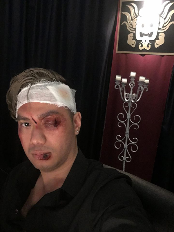 Diễn viên Việt Anh gây chú ý khi chia sẻ bức ảnh anh được hóa trang với nhiều vết thương lớn trên gương mặt. Theo tiết lộ của một diễn viên, Người phán xử bản ngoại truyện dự kiến sẽ có nhiều cảnh đánh đấm, chém giết chân thực hơn so với phiên bản truyền hình. 