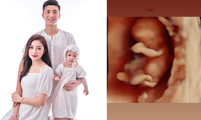 Vợ chồng Phan Văn Đức sắp có em bé thứ hai - Vimarsana News